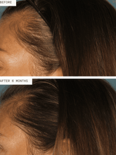 Load image into Gallery viewer, Nutrafol Women Hair Growth Pack - 90 Day Supply