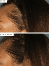 Load image into Gallery viewer, Nutrafol Women Hair Growth Pack - 90 Day Supply
